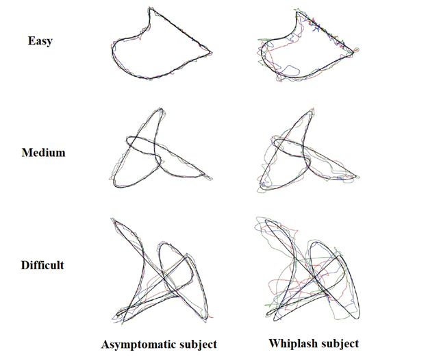 Trois rangées de trajectoires de lignes qui montrent des visualisations faciles, moyennes et difficiles de performances du test papillon pour les sujets asymptomatiques et souffrant d'un coup du lapin.