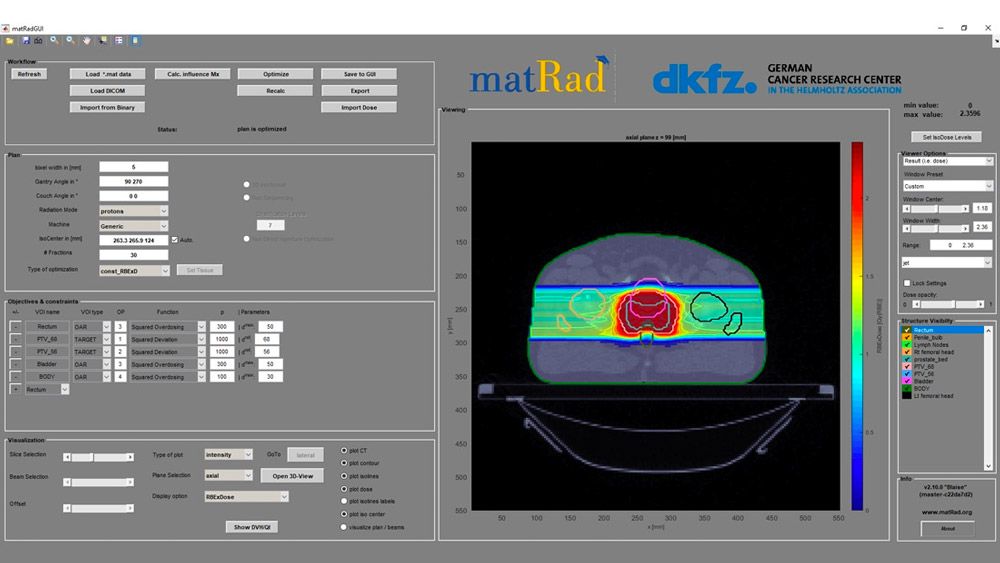 The matRad 2.10.0 interface, with workflow, plan, optimization, and visualization controls.
