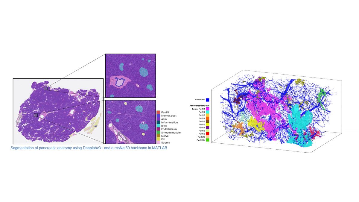 A 3D model of pancreatic tissue showing detailed structures of PanIN lesions, generated using CODA’s deep learning and image registration capabilities. 