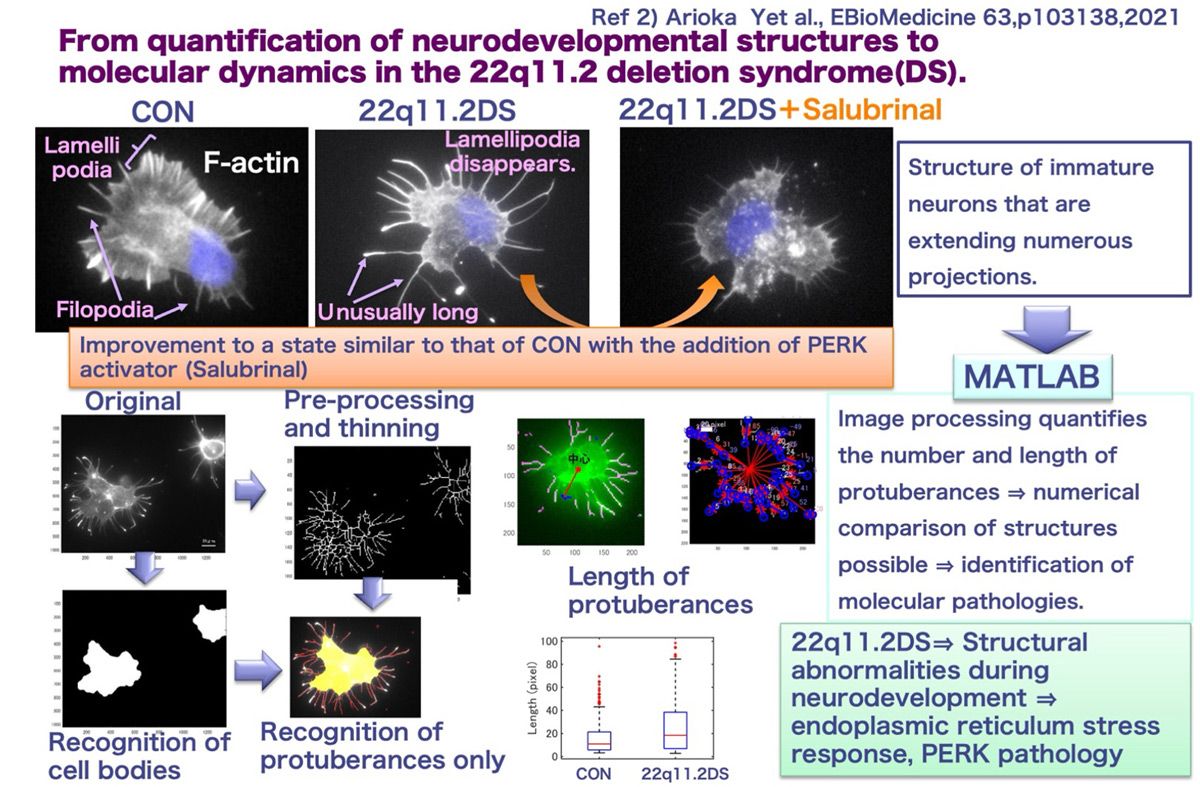 Un flux de travail montrant comment les chercheurs et les professionnels de la santé utilisent MATLAB pour l'analyse des données dans une application de recherche médicale.