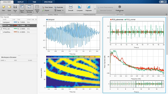 Panorama Des Techniques De Traitement Du Signal Avec MATLAB - Vidéo ...