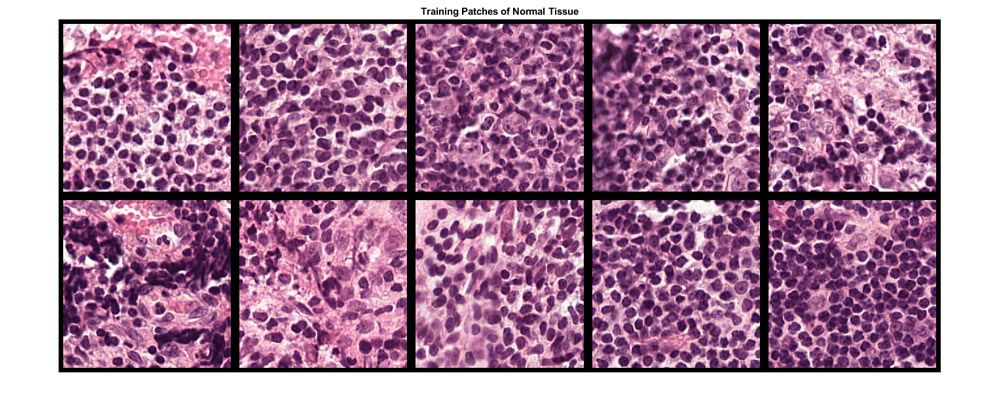 Ten images of tumor tissue used for medical image analysis.