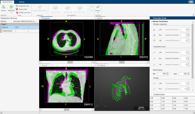MATLAB interface for medical image processing with various volume alignment tools and parameter settings.