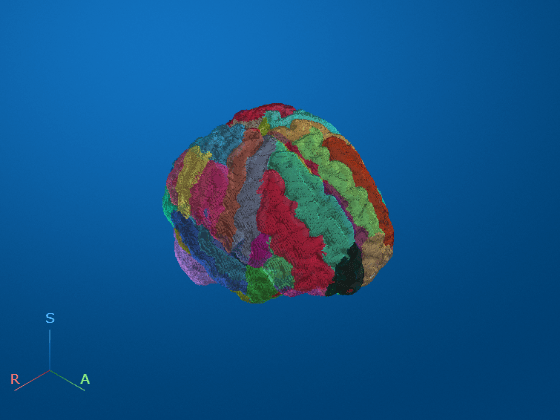 A 3D brain model showcases segmentation in medical image processing with regions labeled using different colors.