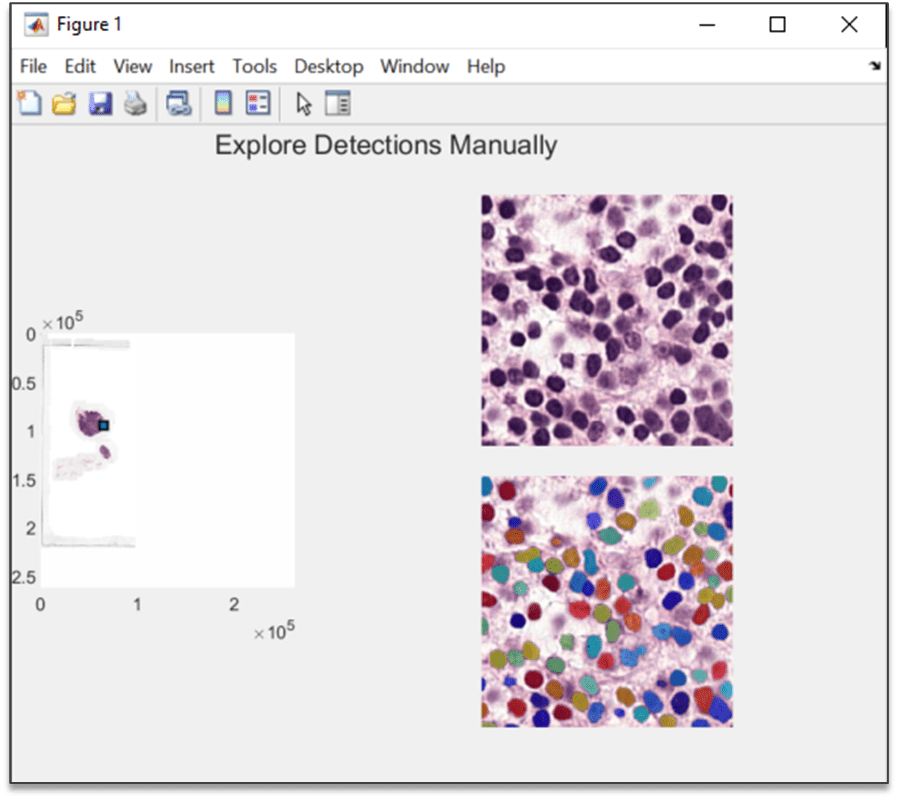 Screenshot showing medical image analysis capability with original and labeled images of tumor tissue.