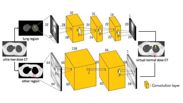 Using Deep Learning to Reduce Radiation Exposure Risk in CT Imaging