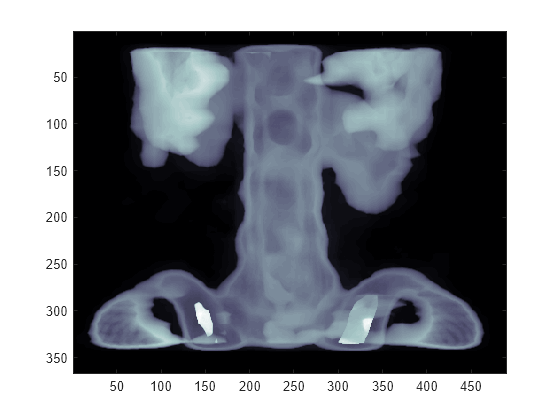 Figure contains an axes object. The axes object contains an object of type image.