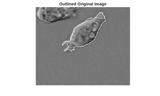 Detect Cell Using Edge Detection and Morphology