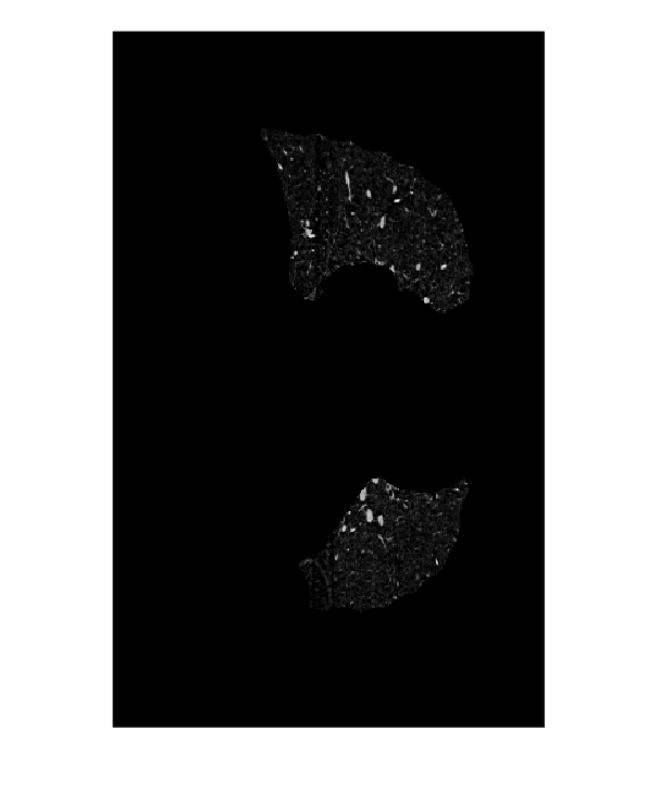 Figure contains an axes object. The hidden axes object contains an object of type image.