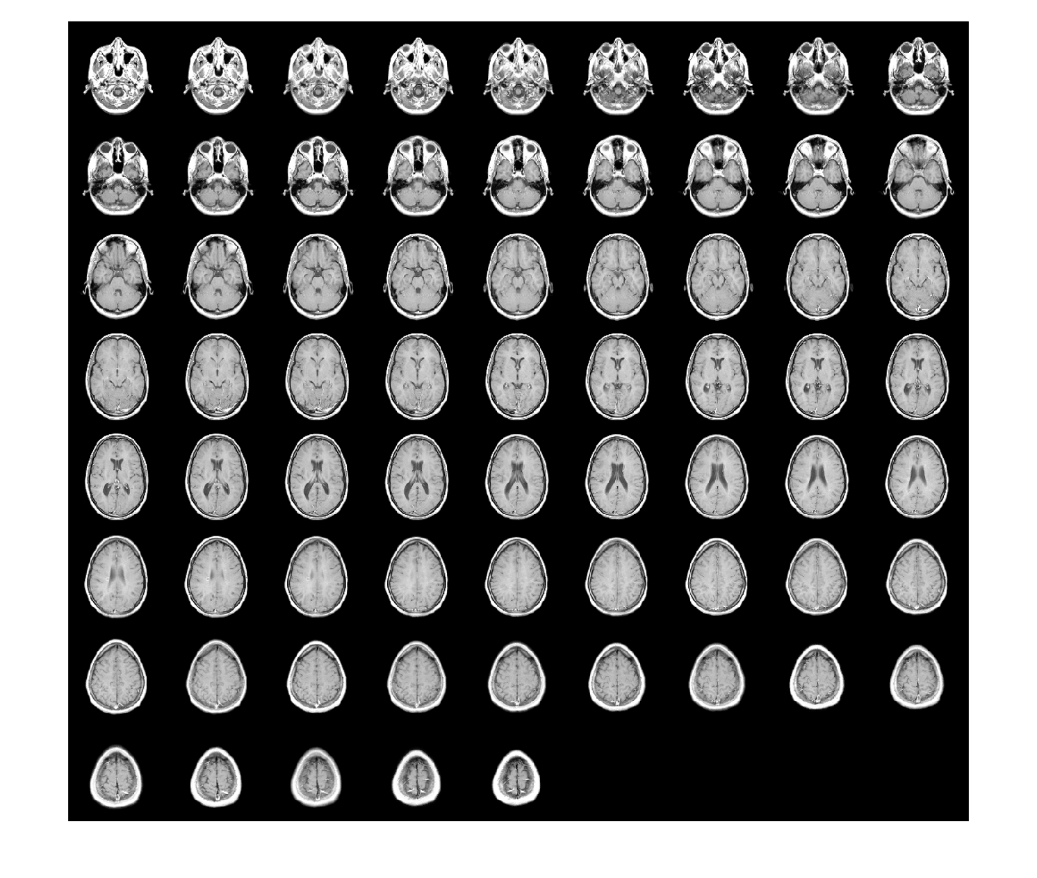 Figure contains an axes object. The axes object with title Transverse Slices contains an object of type image.