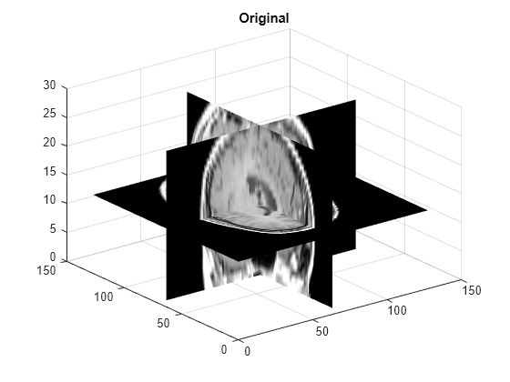 matlab resize image