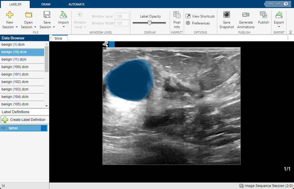 Automate Labeling in Medical Image Labeler