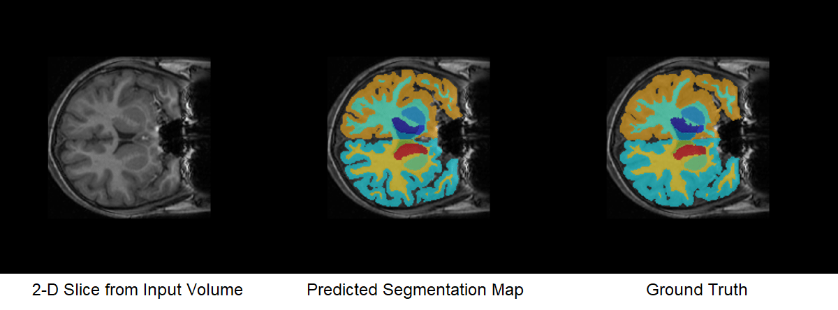 Comparison of Predicted Segmentation Map and Ground Truth Segmentation Map