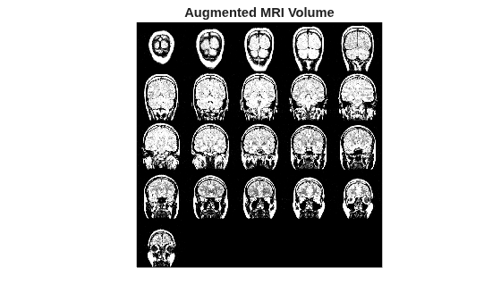 Figure contains an axes object. The hidden axes object with title Augmented MRI Volume contains an object of type image.