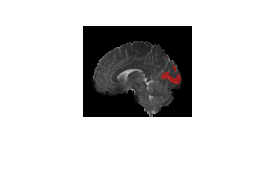 Compute Functional Connectivity from Brain fMRI