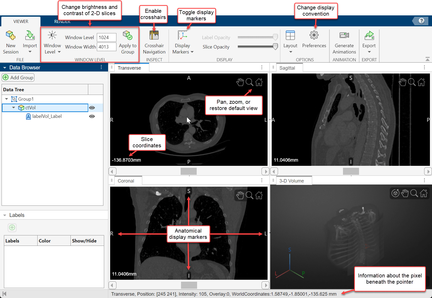 Medical Volume Viewer window with labels showing display markers in the 2-D slice panes and toolstrip options for the 2-D display