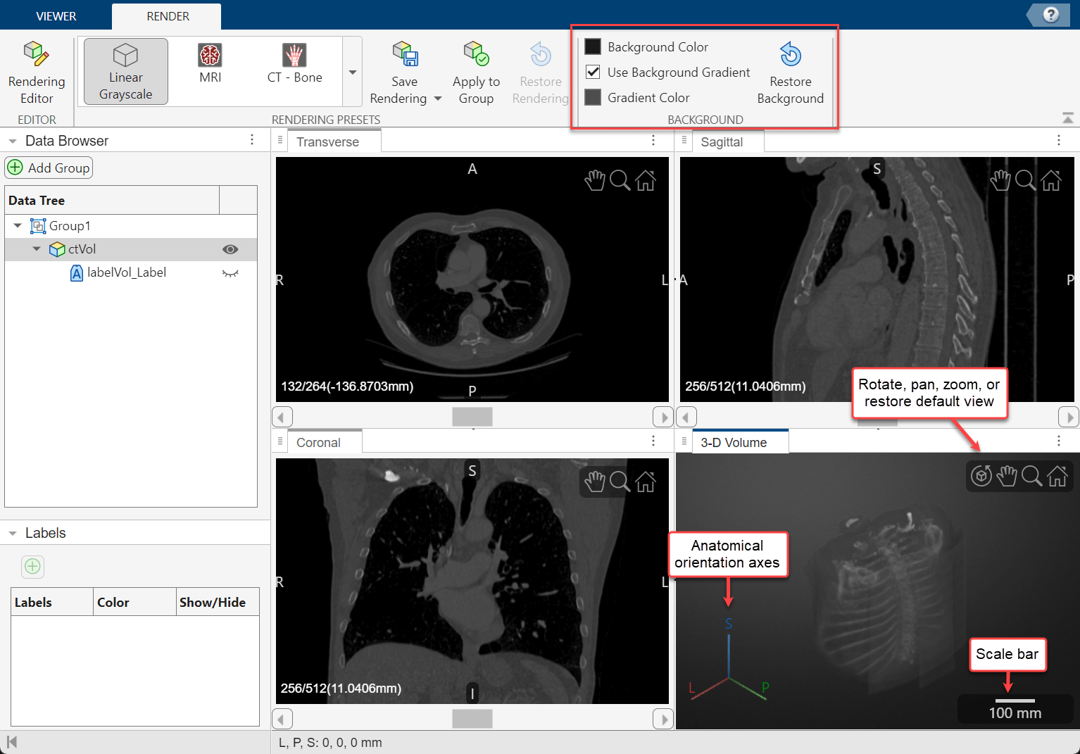 Medical Volume Viewer window with labels showing display markers in the 3-D volume pane and toolstrip options for the 3-D display background