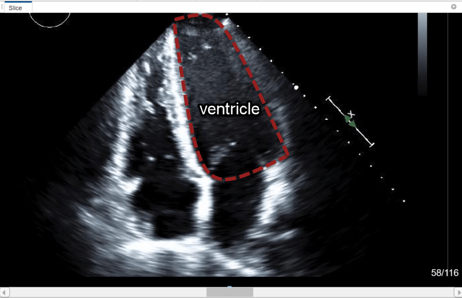 Medical Image Labeler app image session with one echocardiogram image series loaded in the Data Browser