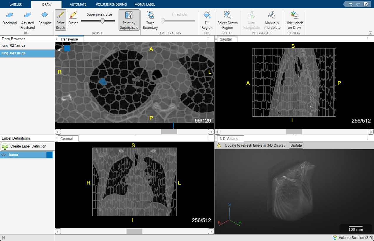 Medical Image Labeler app with second CT volume selected in the Data Browser