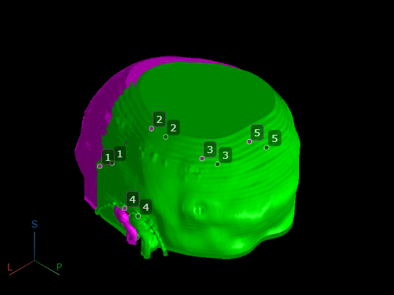 Register 3-D Multimodal Medical Image Volumes Using Anatomical Landmarks