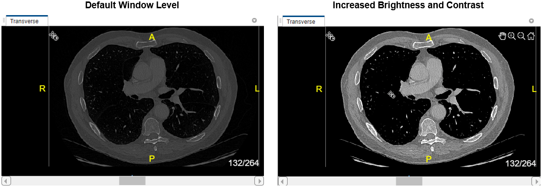 Side-by-side comparison of a 3-D Volume display with the default black background and a custom blue background