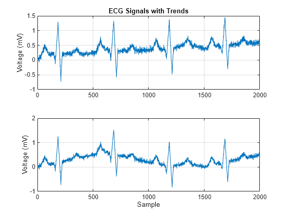 detrend matlab