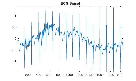 Figure contains an axes object. The axes object with title ECG Signal contains an object of type line.