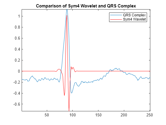 R Wave Detection in the ECG