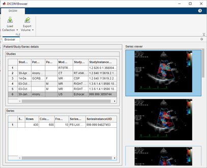 DICOM Browser app