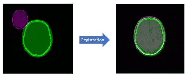 Similarity Registration