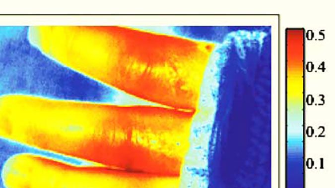 Canada's Institute for Biodiagnostics Develops an Imaging Tool for Assessing Burn Injuries