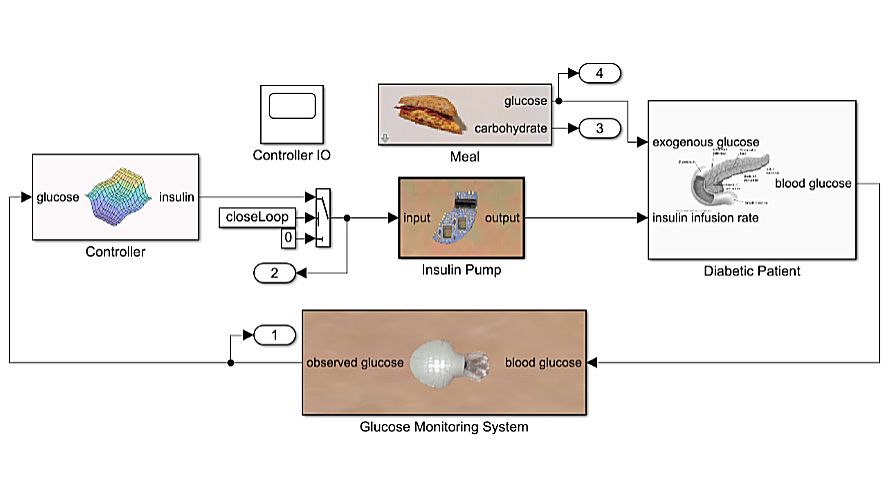 Exemple de modèle de médecine in silico : pancréas artificiel et patient diabétique.