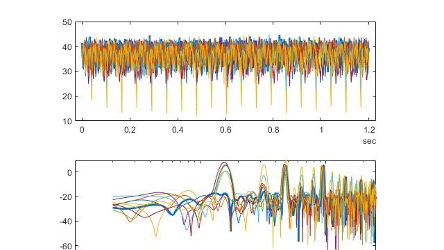 Classification des dysfonctionnements dans une pompe alternative
